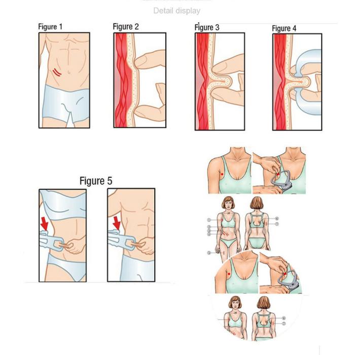 Body Fat Caliper Alat Pengukur Lemak Tubuh